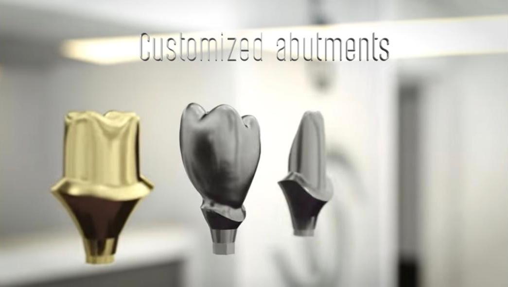 Customized Abutments
