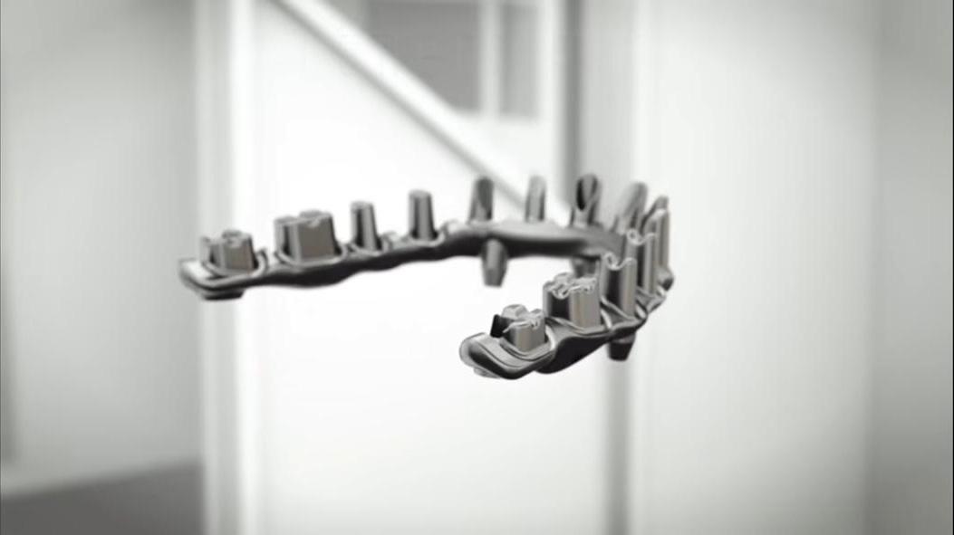 Abutment hybrid