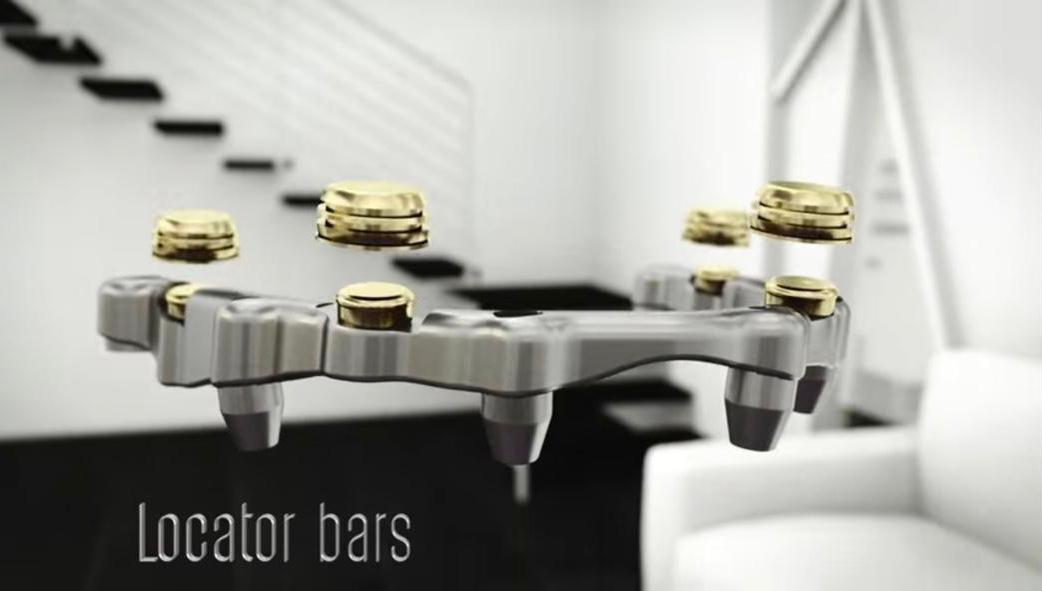 Locator bars