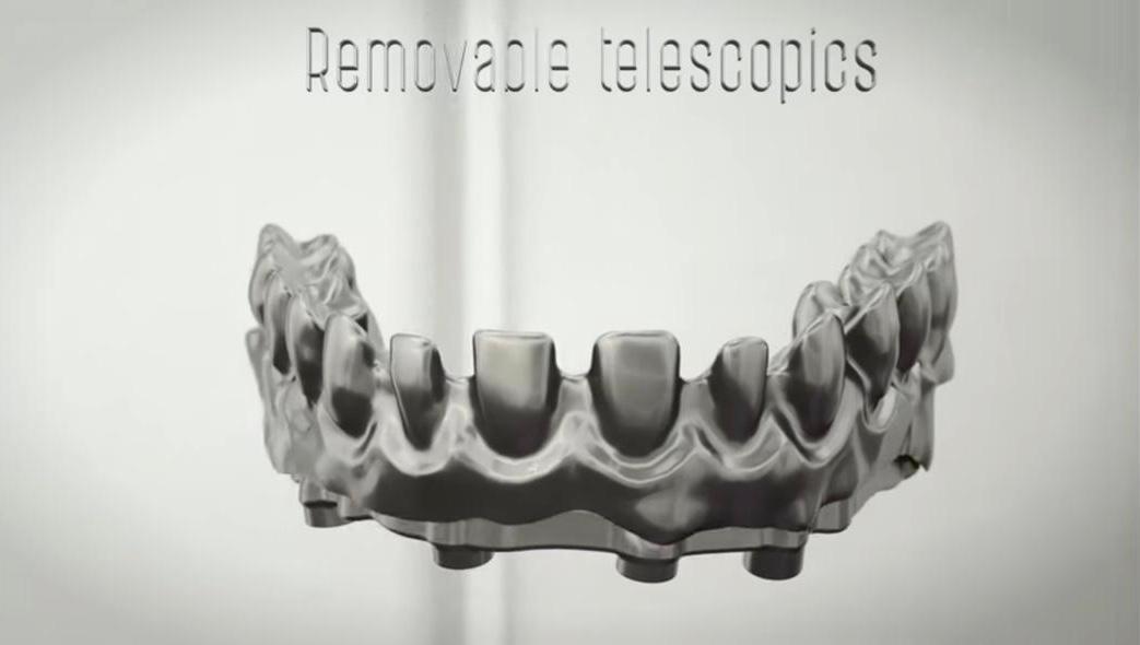 Removable telescopics