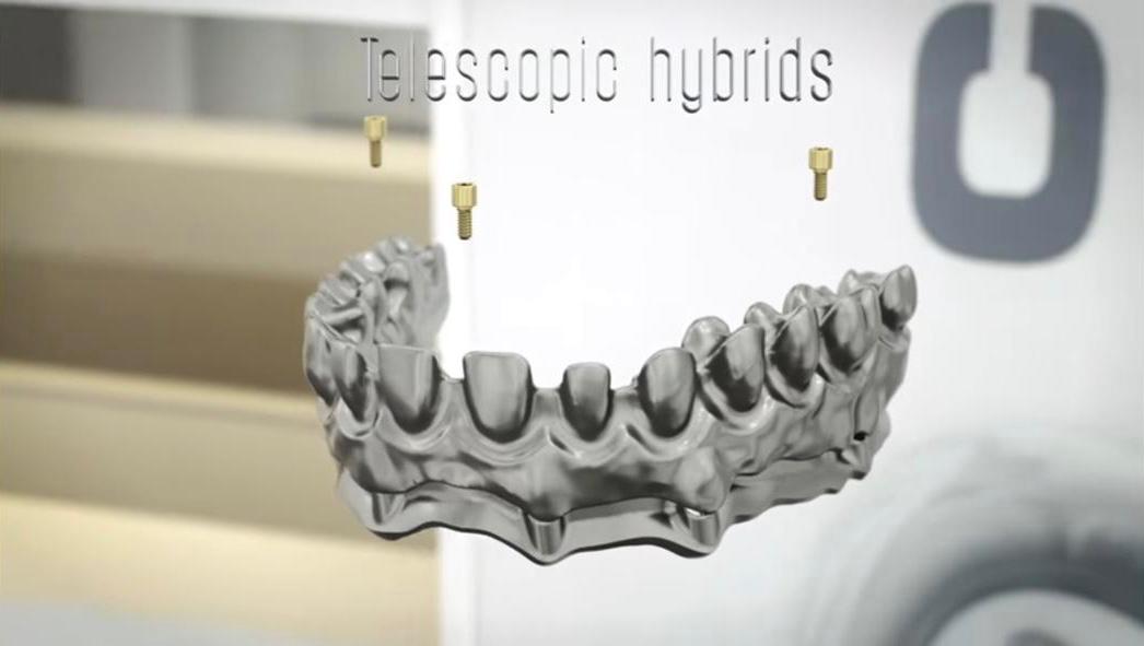 Telescopic hybrids